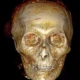 Computed tomography (non-invasive) scan of the mummy of King Amenhotep I